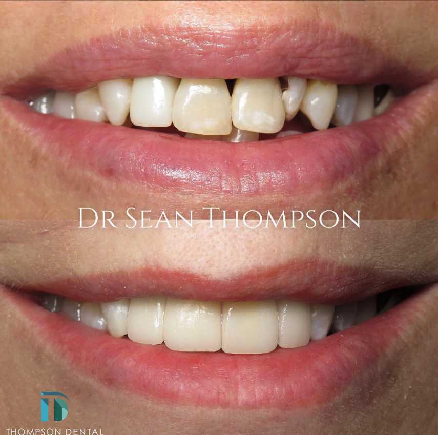 Thompson Dental