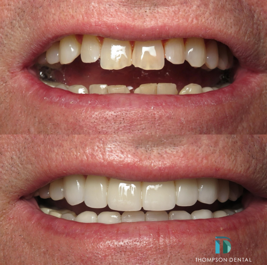 Thompson Dental