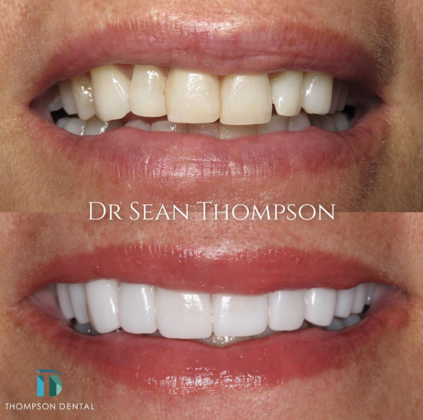Thompson Dental
