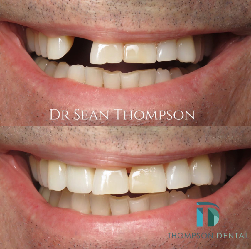 Thompson Dental
