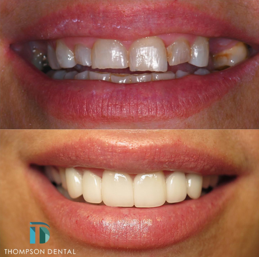 Thompson Dental