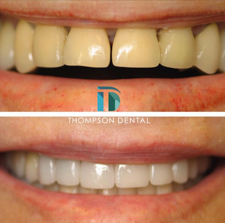 Thompson Dental